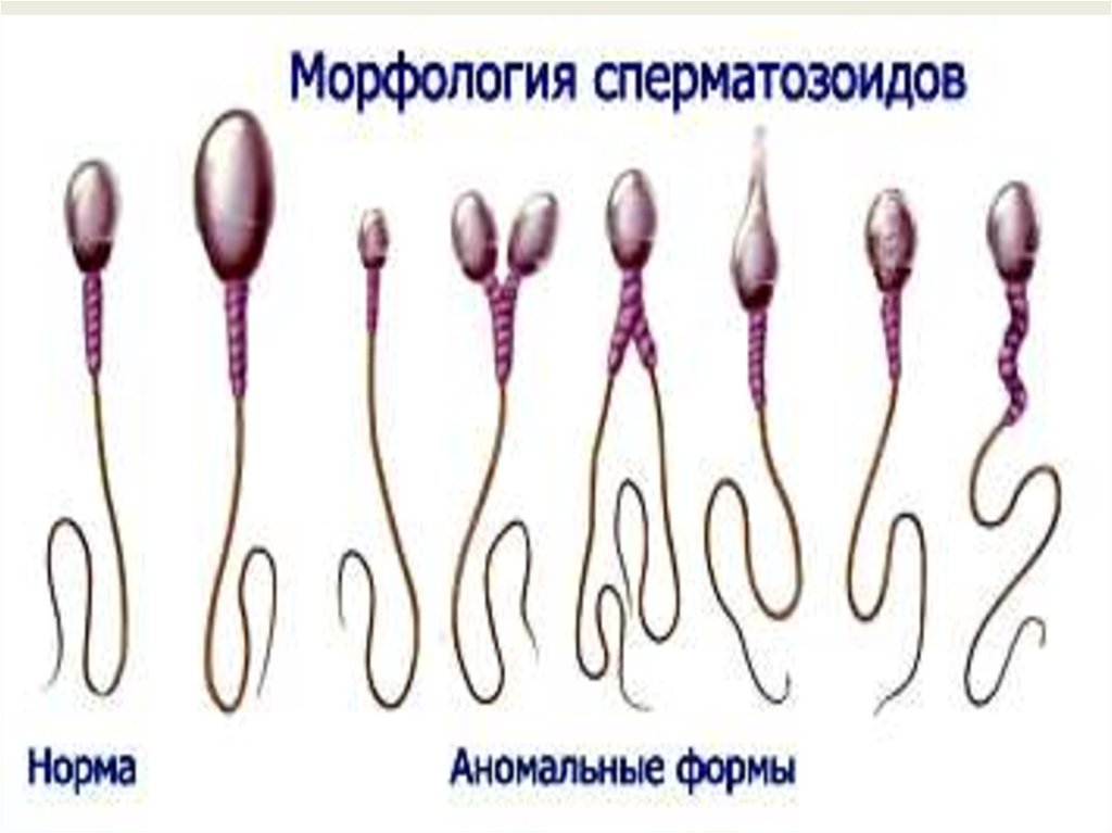 Женские спермии
