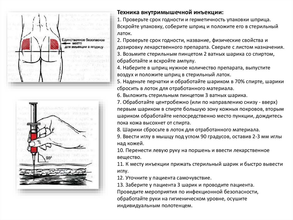 Куда ставить укол в ягодицу внутримышечно фото человека в домашних условиях