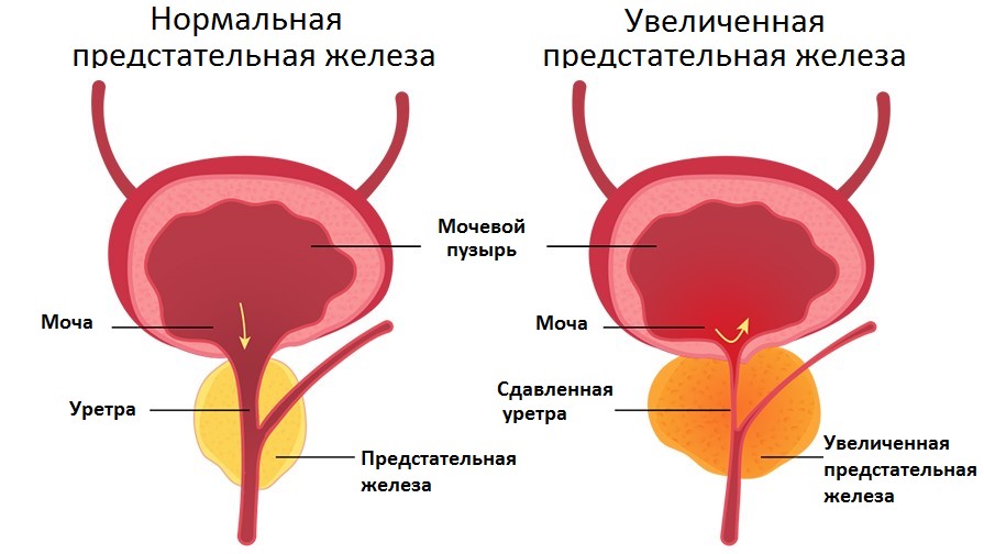 Мужская Простата Где Находится Фото