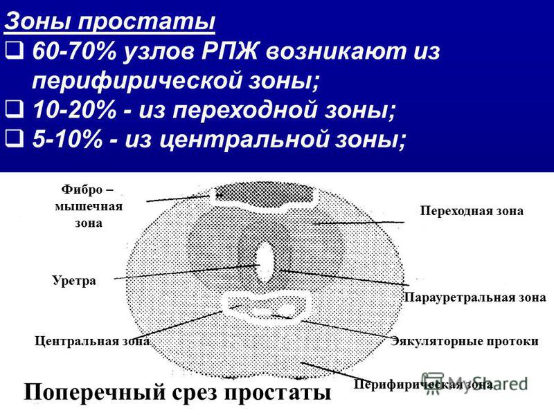 Схема предстательной железы мрт