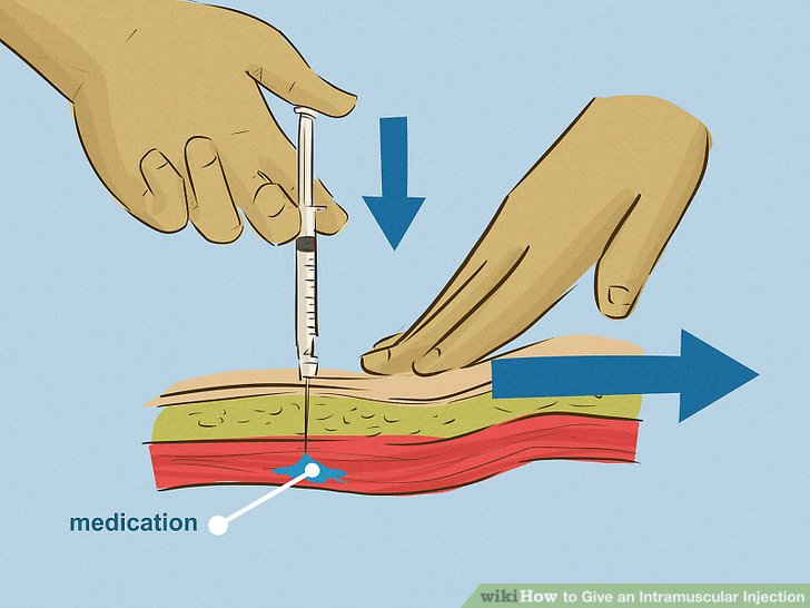 Как правильно держать шприц при уколе в ягодицу фото
