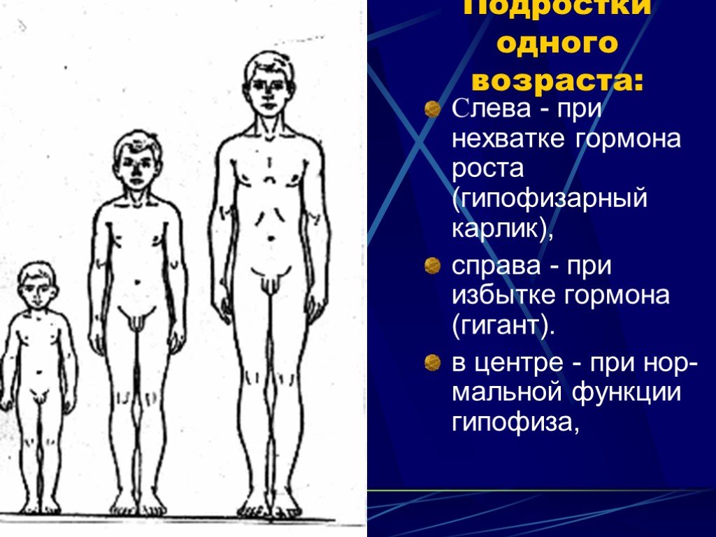 Дефицит роста. Гипофизарная карликовость. Нанизм гипотиреоидный. Церебрально гипофизарный нанизм. Гормоны у подростков.