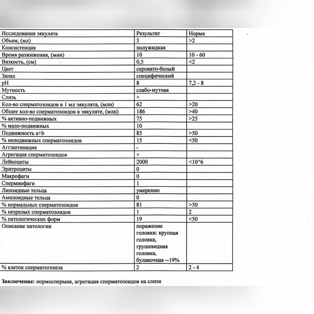 Какую спермограмму сдавать при планировании