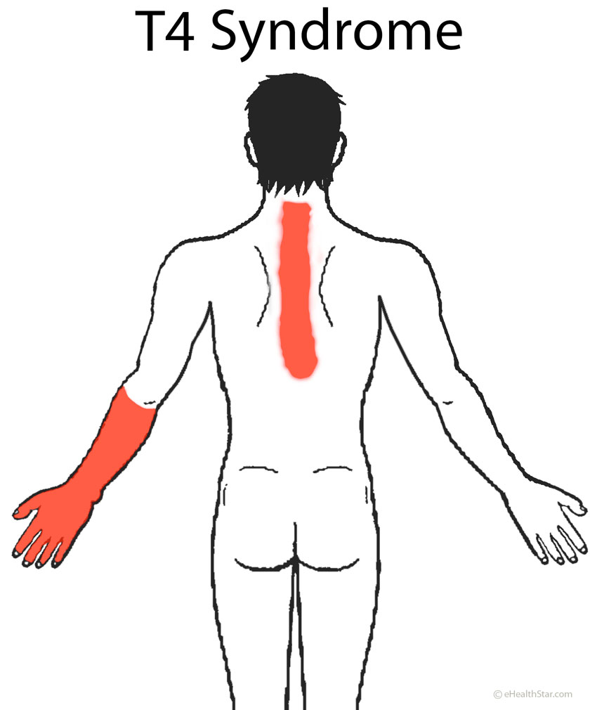 Боль под левую лопатку спины причины лечение