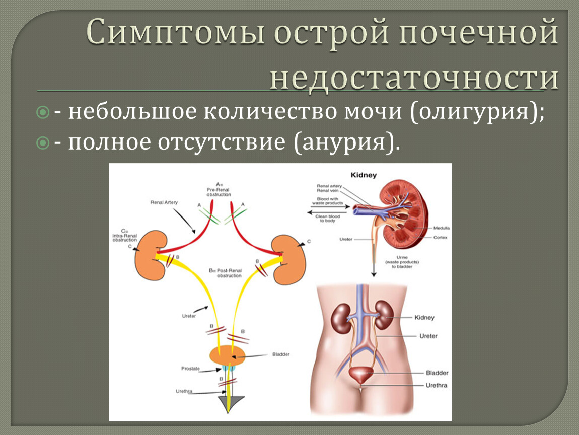 Как происходит почечная недостаточность. Острая почечная недостаточность симптомы у мужчин. Симптомы при почечной недостаточности у женщин. Недостаточность почек симптомы. Симптомы почечнойтнкдостаточности.