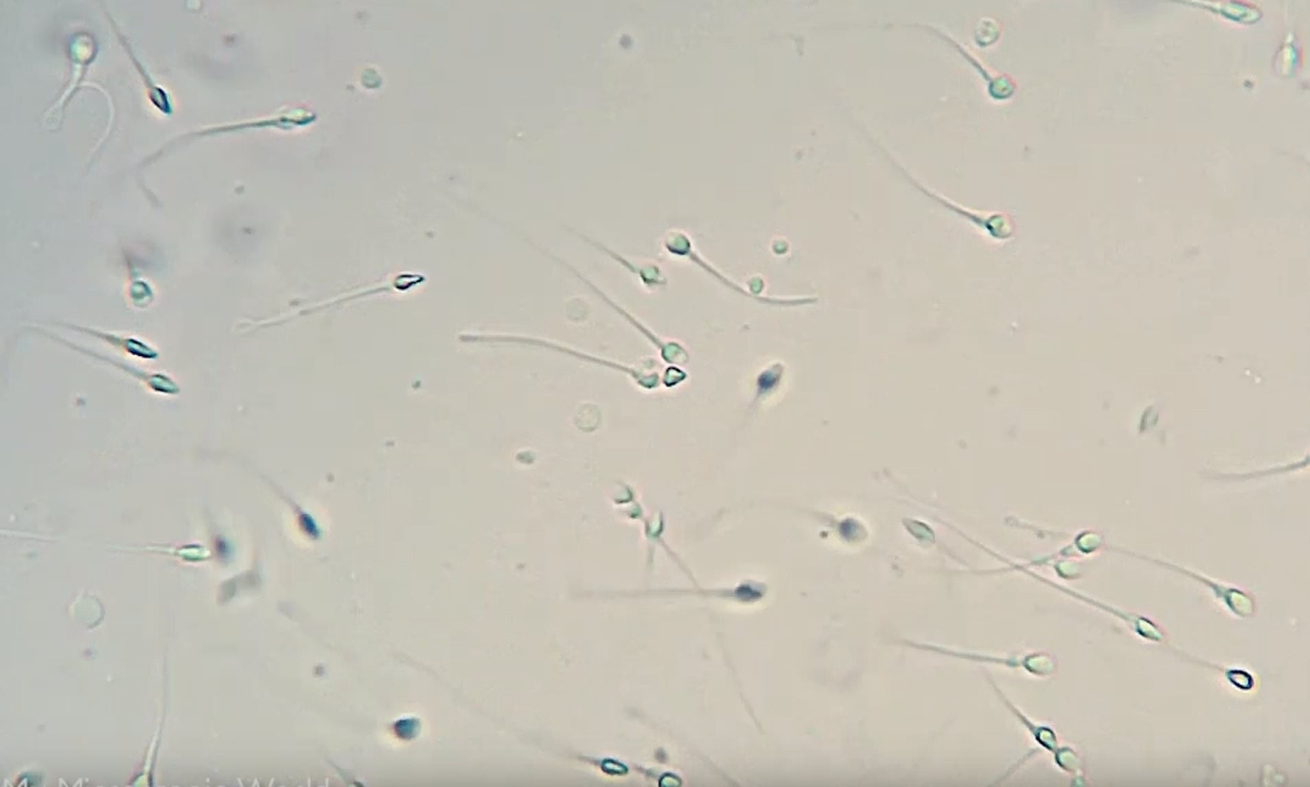 сперма много спермы видео много малолетки фото 115