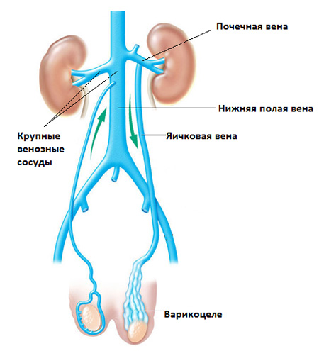 Правое яичко