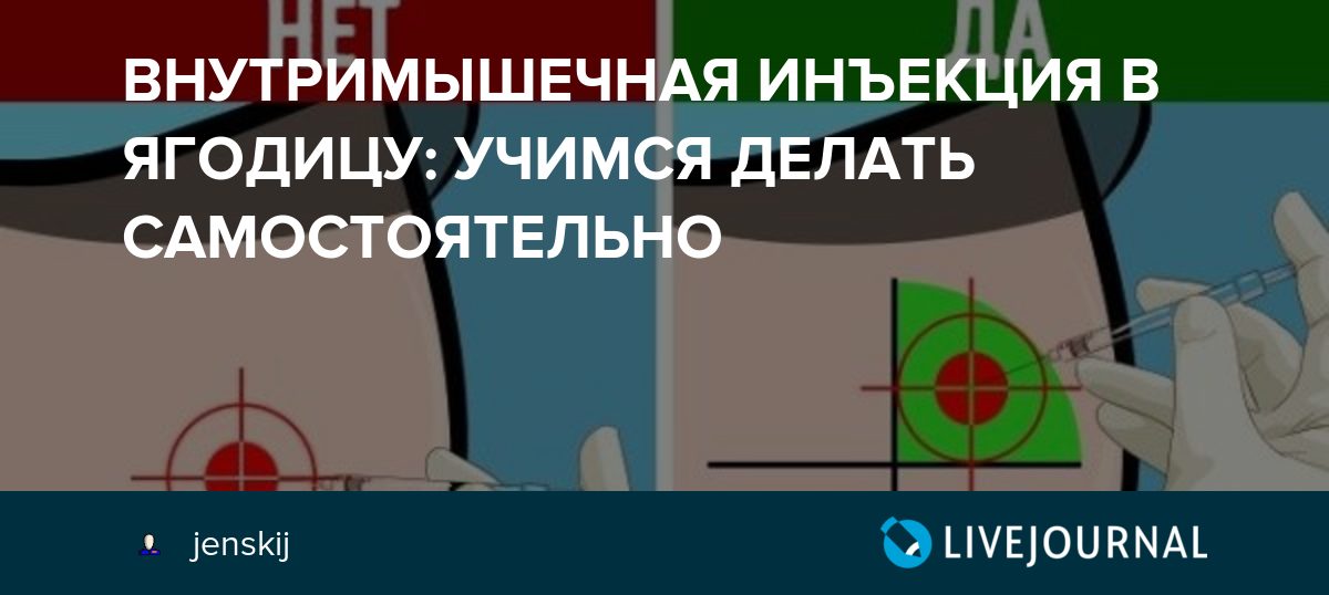 Внутримышечный укол в ягодицу куда колоть фото