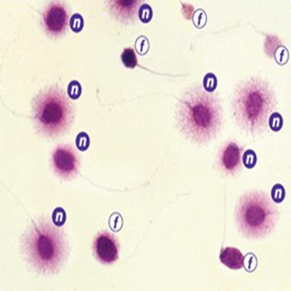 Фрагментация днк. Фрагментация ДНК хроматин. Фрагментация сперматозоидов. Фрагментация ДНК И морфология спермограммы. Выявление фрагментации ДНК В сперматозоидах (tunel)..