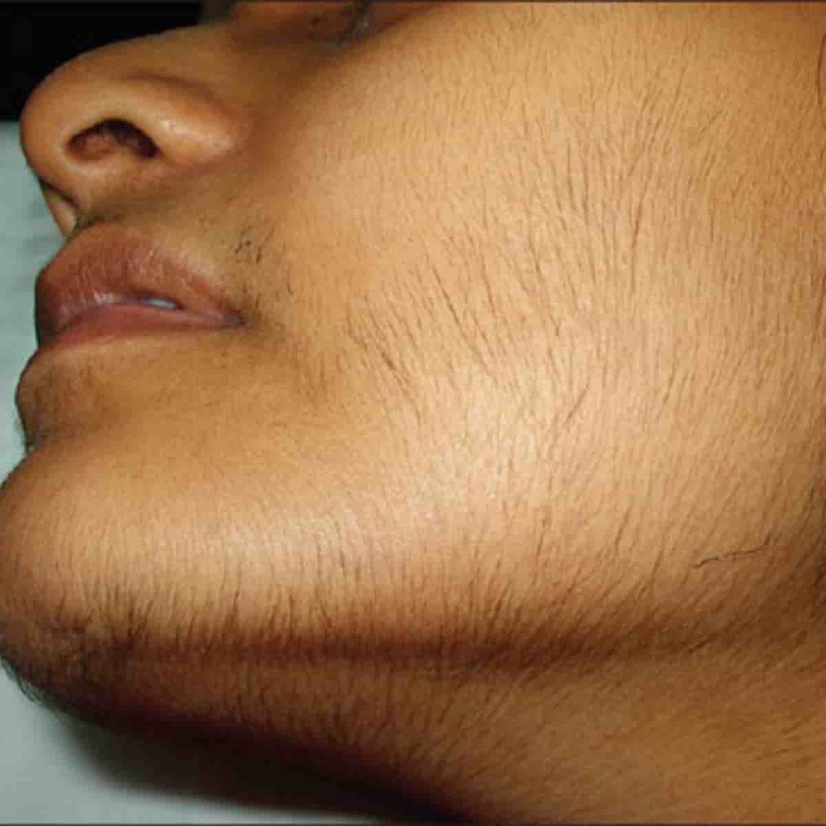 рост волос на лице и груди у женщин фото 7