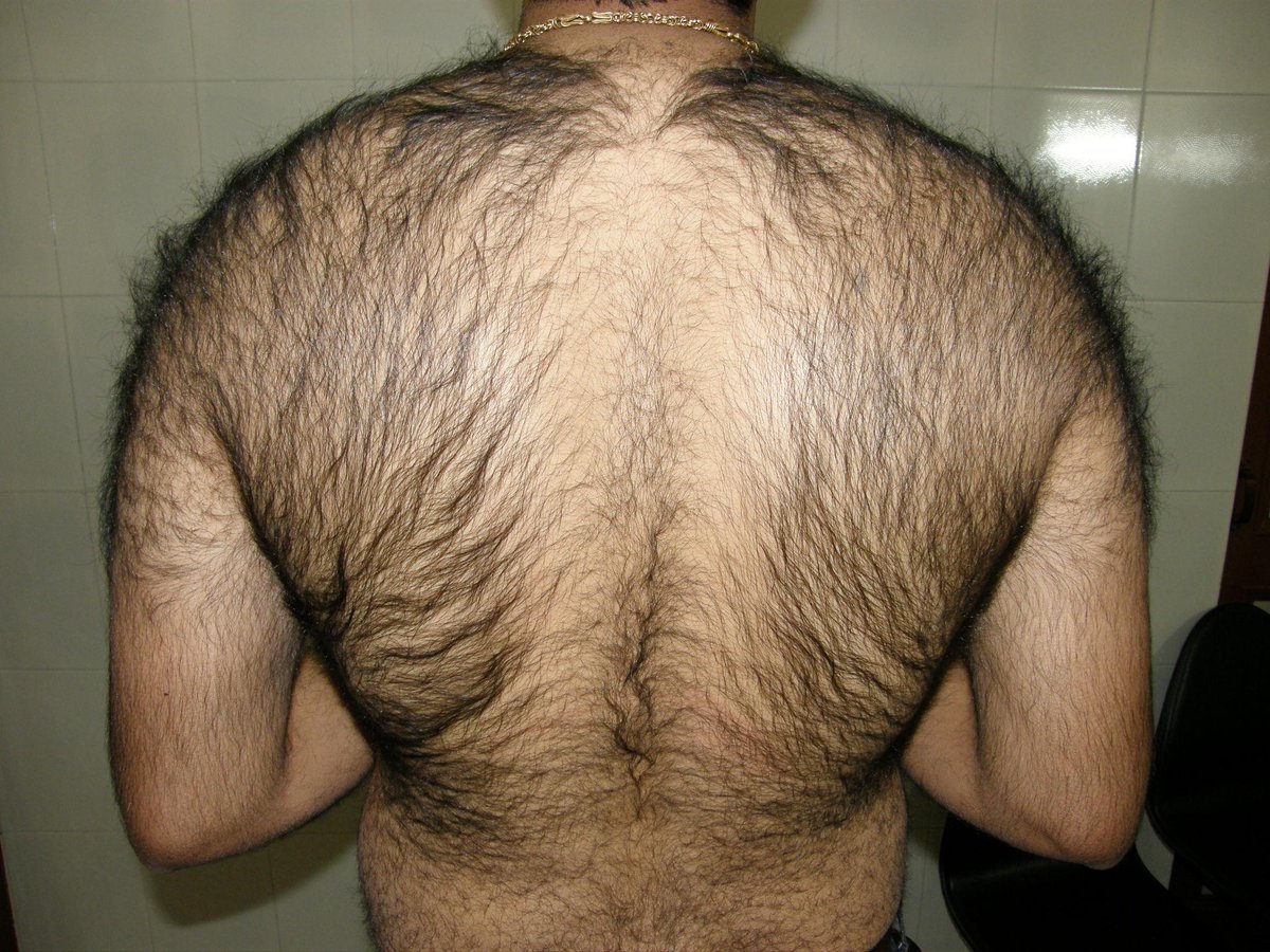 рост волос на груди у женщин причины фото 80
