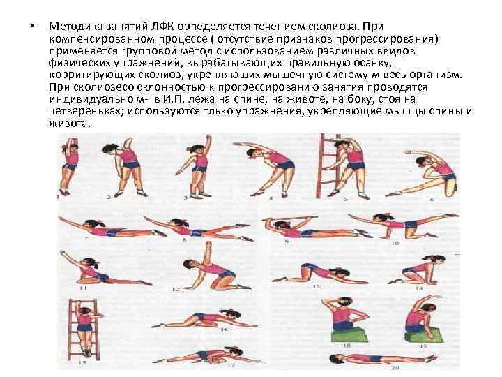 Комплекс упражнений при сколиозе с картинками и описанием